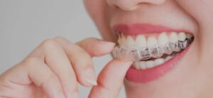 Read more about the article Why More Adults Are Choosing Invisible Braces in Neutral Bay
